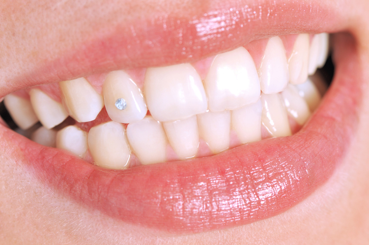 What Are Tooth Piercings and Are They Safe?
