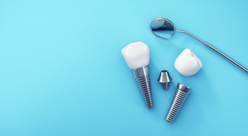 Four Common Dental Implant Problems