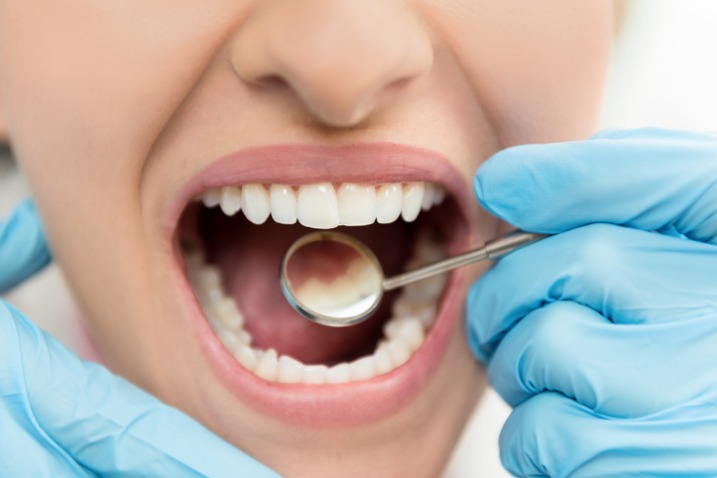 close up of female patient receiving a dental exam
