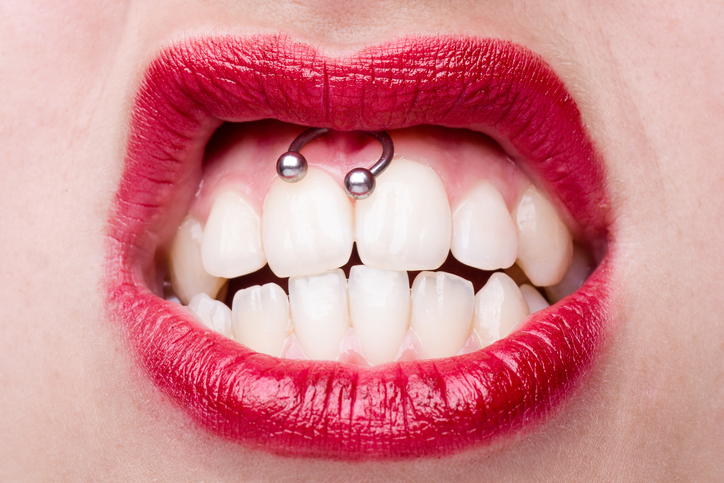 Are Gum Piercings Safe?