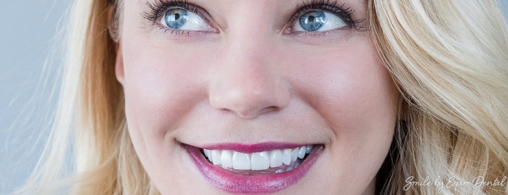 close up of attractive woman smiling with straight white teeth