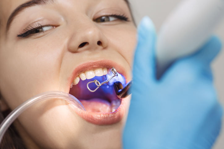Can Dental Bonding Fix My Periodontal Disease?