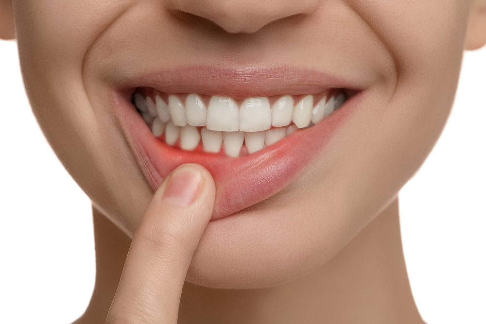 Where Can I Get Periodontal Disease Treatment in Wyoming?