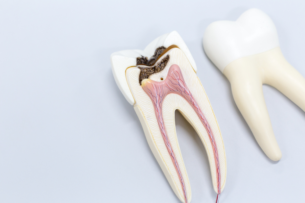 How Long Does it Take to Do a Root Canal in Wyoming?